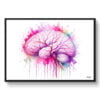 dream watercolour cerebral angiography side front view