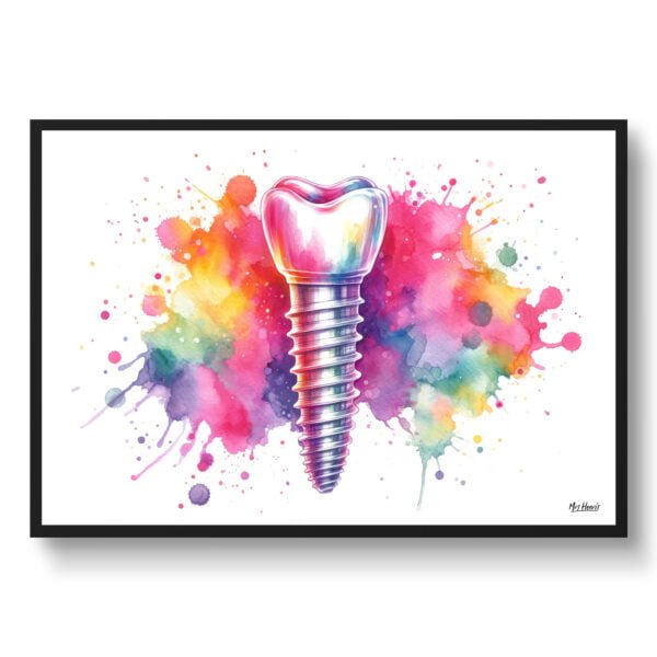 dream watercolour dental implant front view