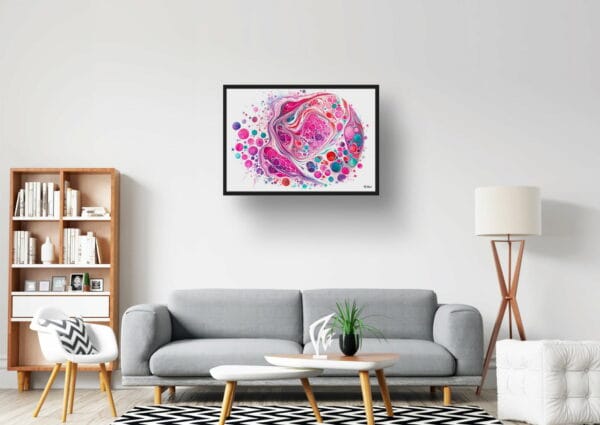 dream watercolour micrograph of follicular thyroid carcinoma circular lobby 1